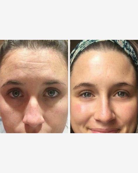 Load image into Gallery viewer, Ultimate Anti-Ageing Bundle