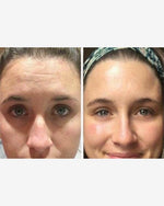 Load image into Gallery viewer, Ultimate Anti-Ageing Bundle