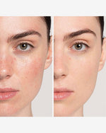 Load image into Gallery viewer, Ultimate Anti-Ageing Bundle