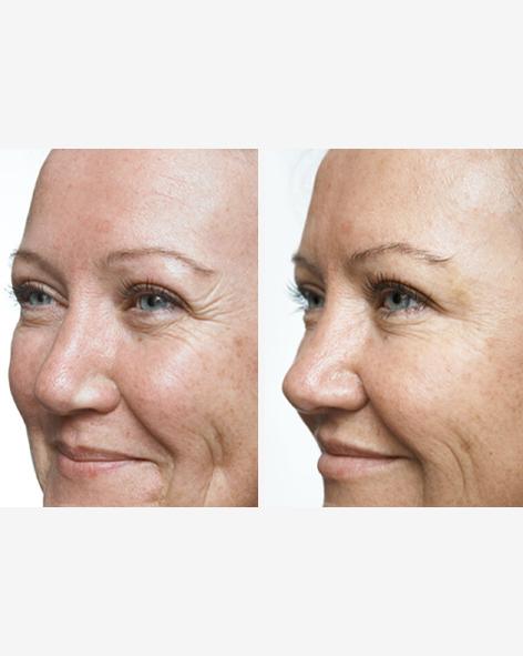 Load image into Gallery viewer, Ultimate Anti-Ageing Bundle