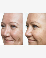 Load image into Gallery viewer, Ultimate Anti-Ageing Bundle