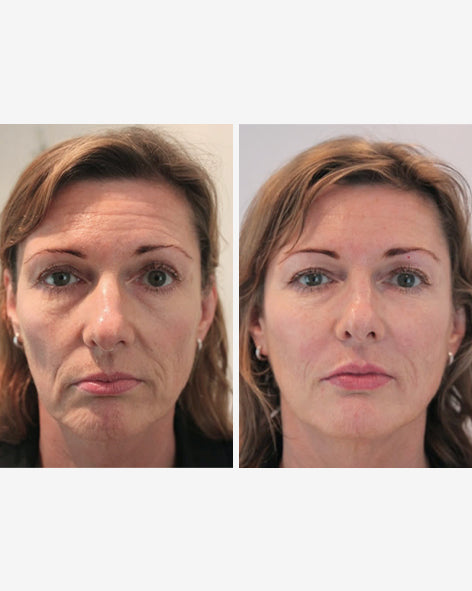 Load image into Gallery viewer, Youth Revival Night Cream