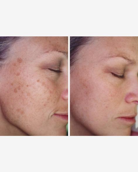 Load image into Gallery viewer, Ultimate Anti-Ageing Bundle