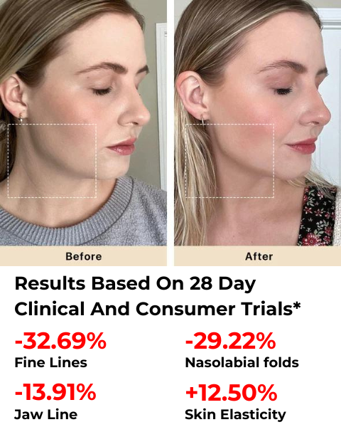 Load image into Gallery viewer, Amiro R1 PRO Facial RF Skin Tightening Device
