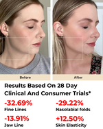 Load image into Gallery viewer, Amiro R1 PRO Facial RF Skin Tightening Device
