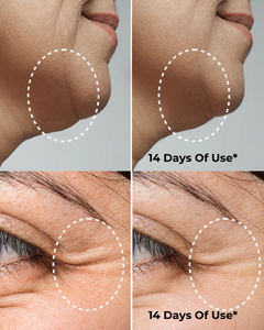 Amiro R1 PRO Facial RF Skin Tightening Device
