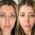 Load image into Gallery viewer, Amiro R1 PRO Facial RF Skin Tightening Device
