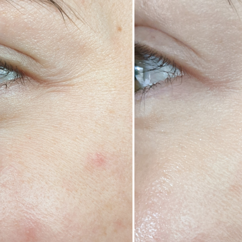 Load image into Gallery viewer, Amiro R1 PRO Facial RF Skin Tightening Device
