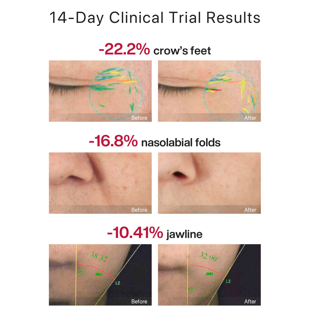 Load image into Gallery viewer, Amiro R1 PRO Facial RF Skin Tightening Device
